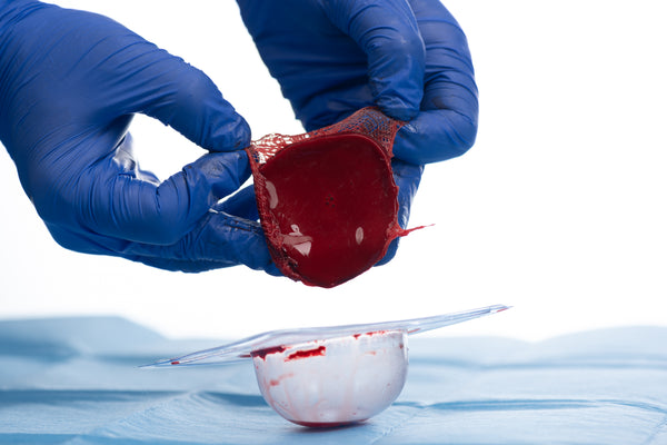 ActiGraft kit, σύστημα σχηματισμού αυτόλογου θρόμβου αίματος για την διαχείριση τραυμάτων