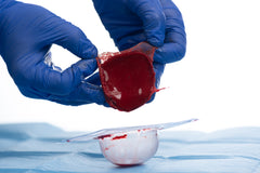 ActiGraft kit, σύστημα σχηματισμού αυτόλογου θρόμβου αίματος για την διαχείριση τραυμάτων